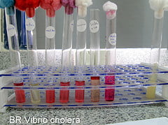 Biochemical test for Vibrio cholerae