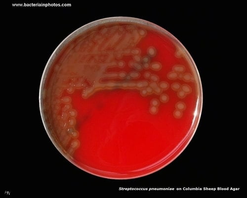 Cultural Characteristics of Streptococcus