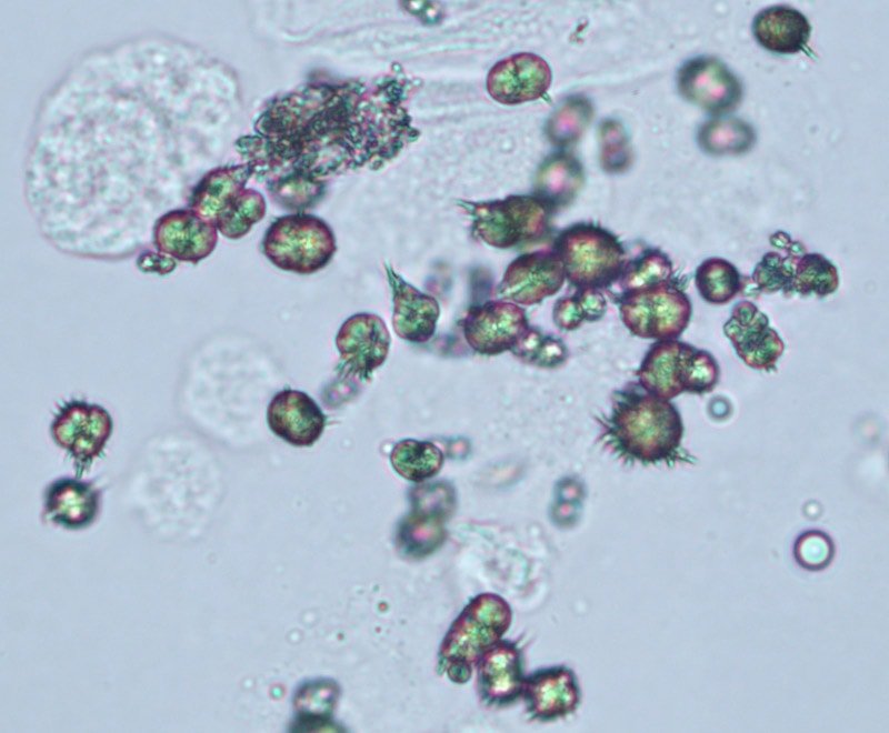 Cristaux de biurate d'ammonium