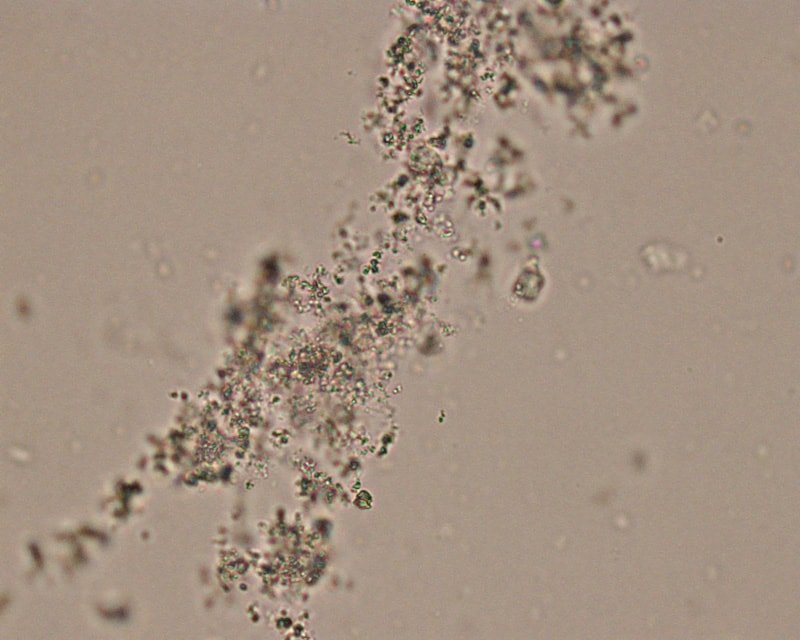 what causes calcium oxalate crystals in urine in dogs