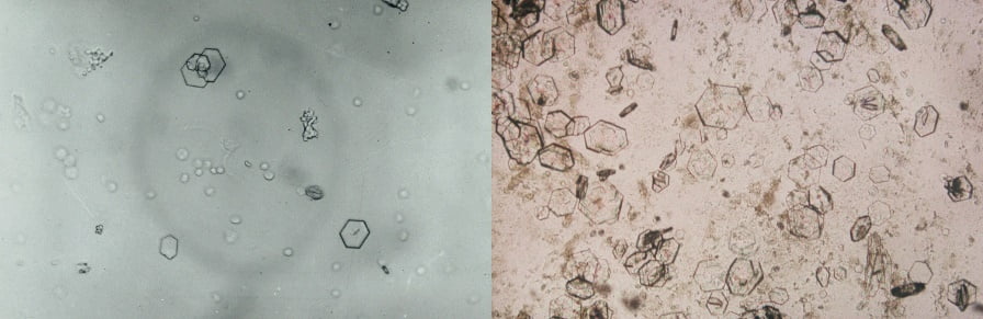 what causes calcium oxalate crystals in urine in dogs