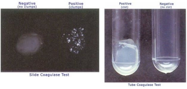 staphylococcus aureus catalase test