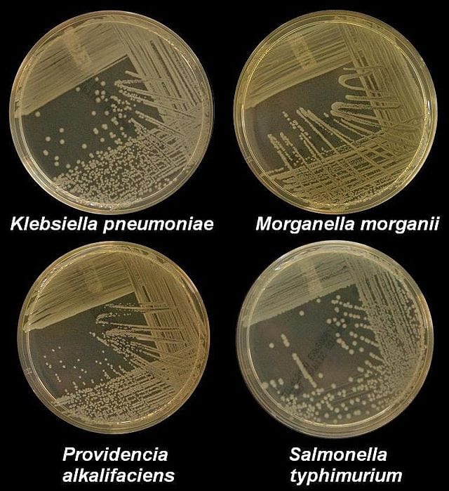 Four nutrient agar plates growing colonies of common Gram negative bacteria.