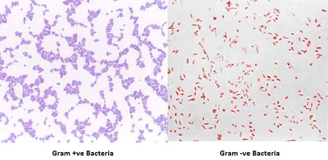 Gram Stain Interpretation Chart