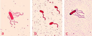 Interpretation of Flagella Staining