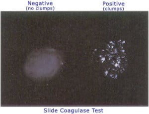 Slide Test (to detect bound coagulase)