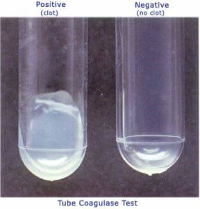 Tube Test (to detect free coagulase)