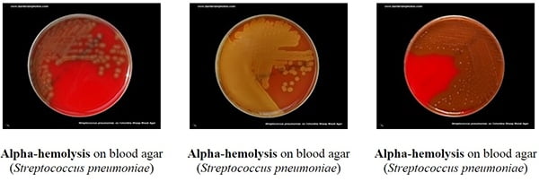 Haemolysis of Streptococci and its types with examples