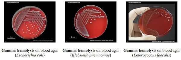 composition of blood agar