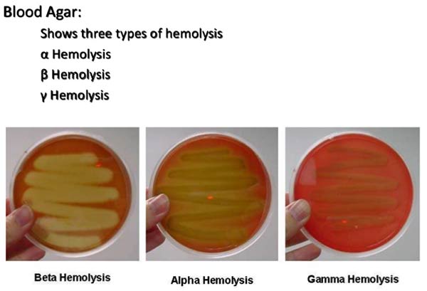 4 blood agar and hemolysis and mac-conkey.ppt