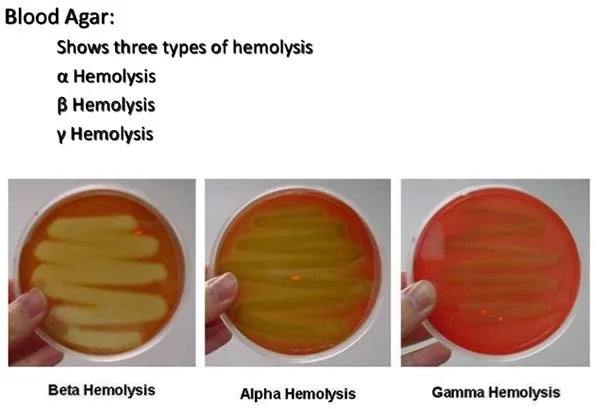 Haemolysis of Streptococci and its types with examples