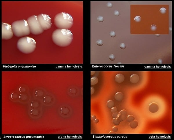 streptococcus pneumoniae colony morphology