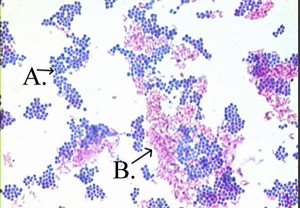 Acid-Fast Stain- Principle, Procedure, Interpretation And Examples