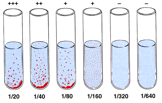 Interpretation of Widal Test- Tube Method