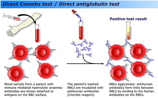 slide agglutination test procedure