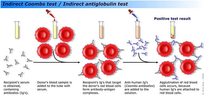 Indirect-Coombs-Test