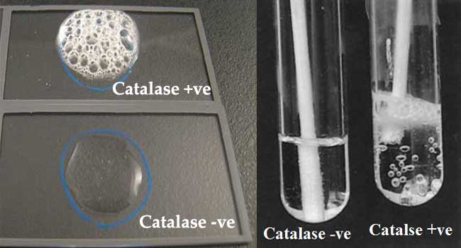 Result Interpretation of Catalase Test and Examples