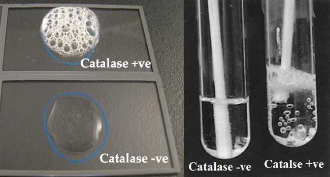 staphylococcus aureus catalase test