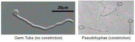 Results and Interpretation of Germ Tube Test