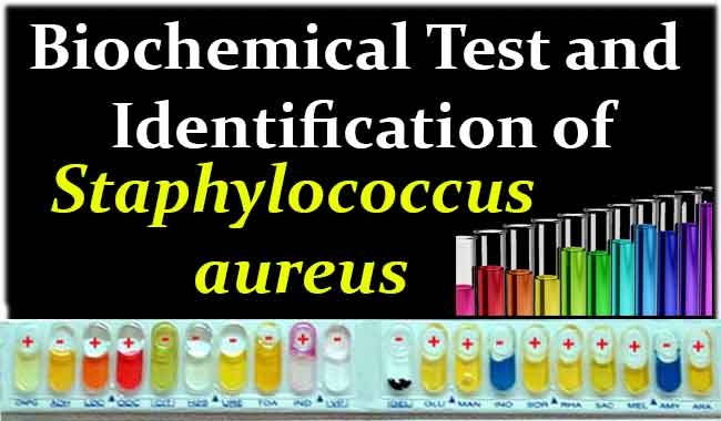 test lab blood glucose and of Test Identification Staphylococcus aureus Biochemical