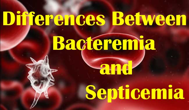 Differences Between Bacteremia and Septicemia
