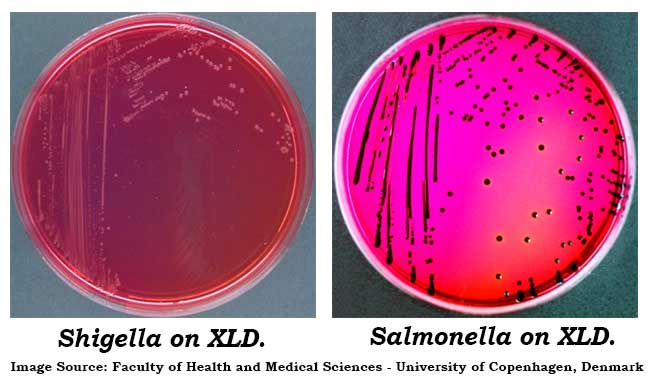 Shigella and Salmonella Colonies on XLD Agar