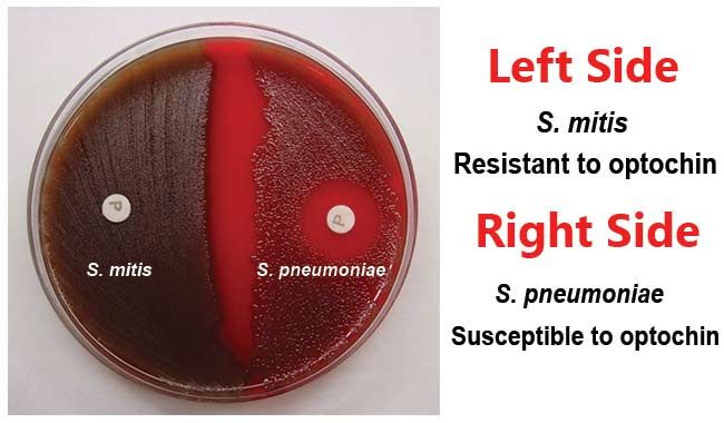 Result Interpretaion of Optochin Susceptibility Test