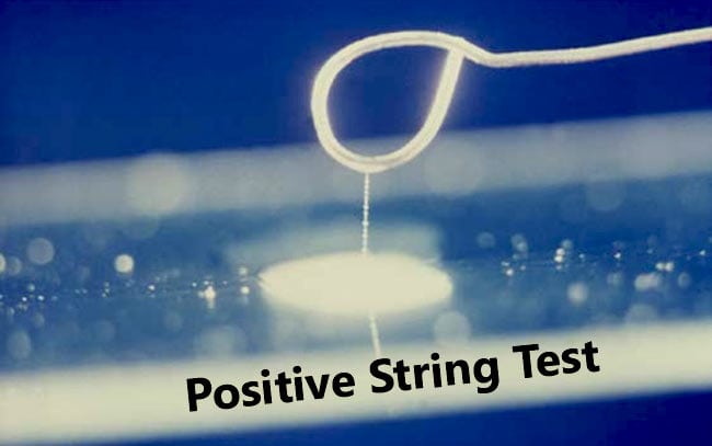 Result of String Test