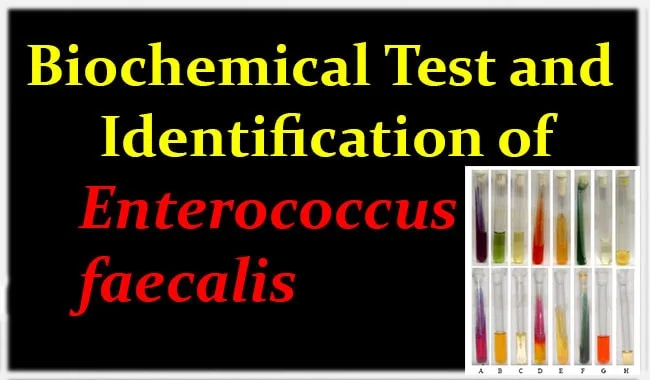 Biochemical Test and Identification of Enterococcus faecalis