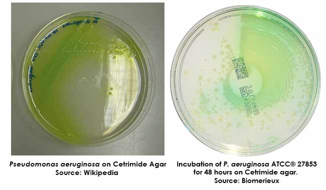 pseudomonas aeruginosa on macconkey agar