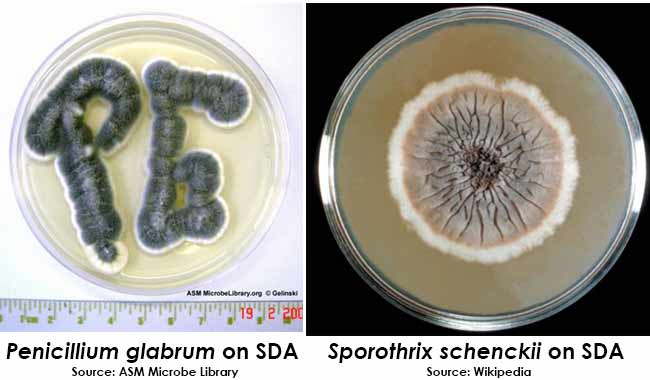 Sabouraud Dextrose Agar (SDA) - Principle, Uses and Colony Morphology