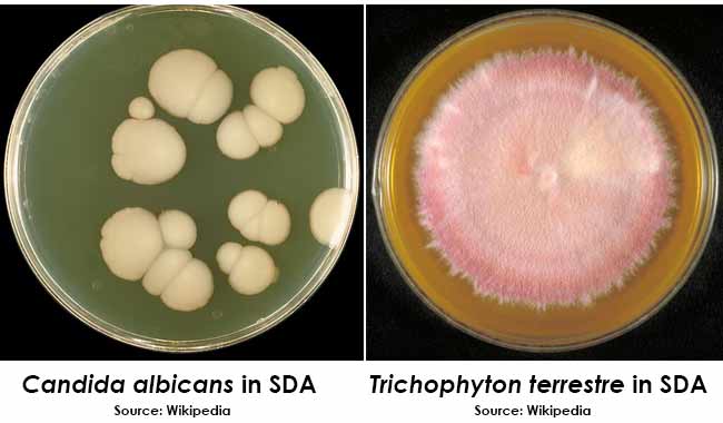Colony Morphology on SDA