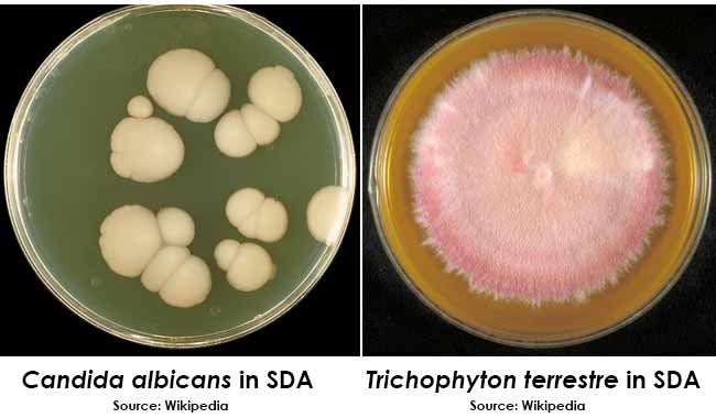 candida colony