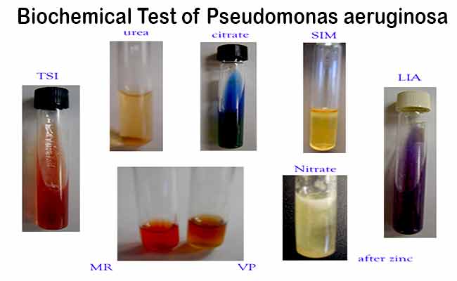 nitrate reduction test e coli