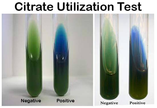 Result Interpretation of Citrate Utilization Test