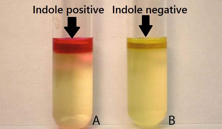 Interprétation du résultat du test à l'indole