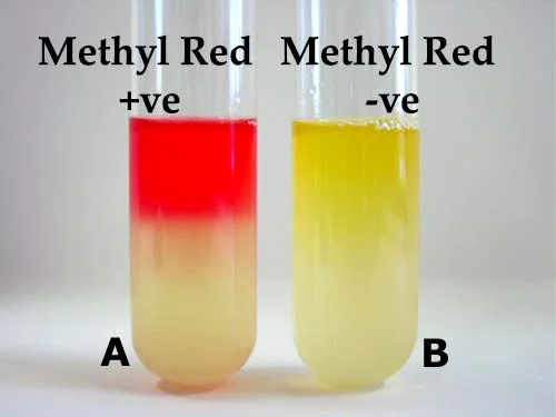 Result Interpretation of MR test