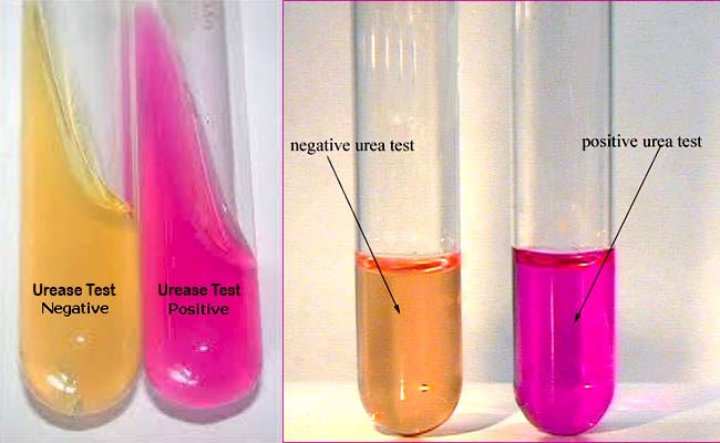 Result Interpretation of Urease Test