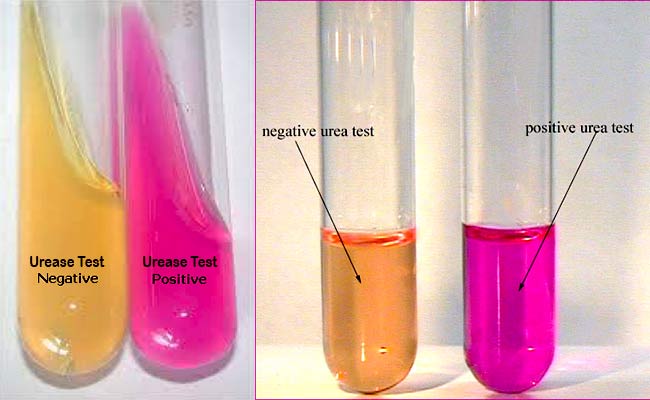 Urease Test Principle Media Procedure And Result