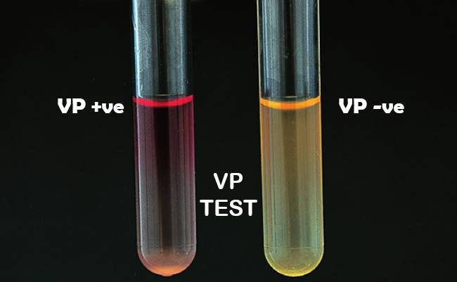 Result Interpretation of Voges–Proskauer (VP) Test