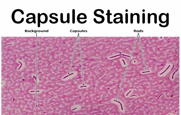 klebsiella pneumoniae capsule stain