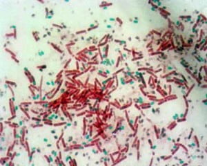 Endospore Staining- Principle, Reagents, Procedure And Result