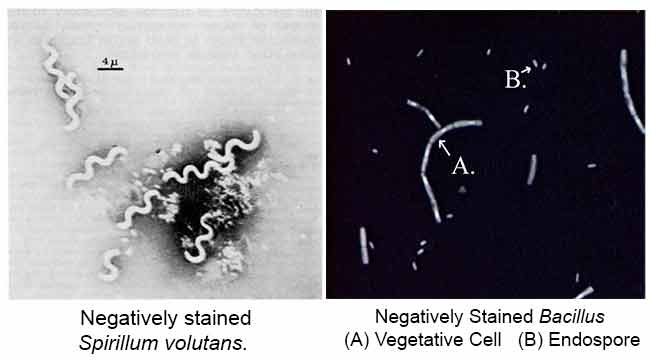 Negative Staining Principle, Reagents, Procedure and Result