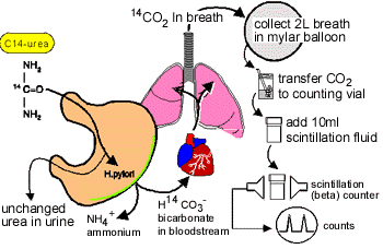 Urea Breath Test