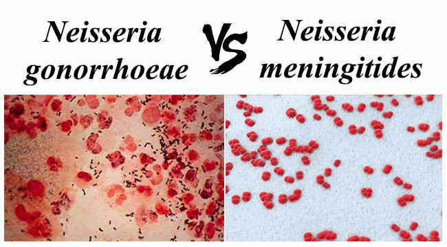 Difference between Neisseria gonorrhoeae and Neisseria meningitidis