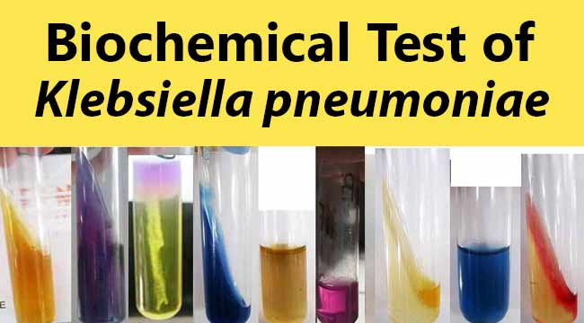 biochemical test and identification of klebsiella pneumoniae microbiology info com