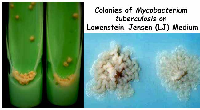 Colony Morphology on LJ Medium