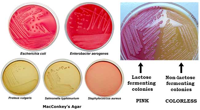 List of culture media used in microbiology with their uses