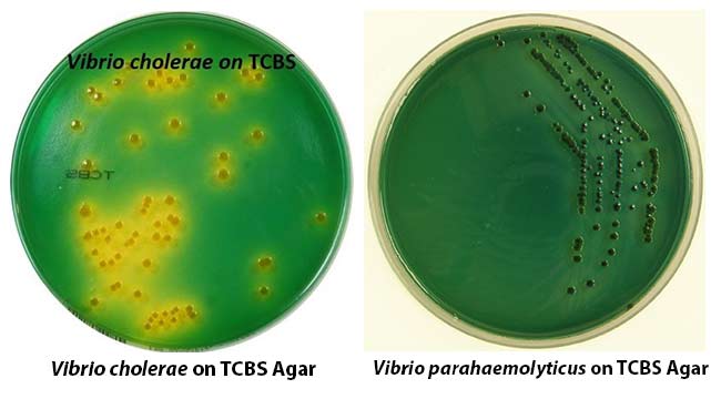 Colony Morphology on TCBS Agar