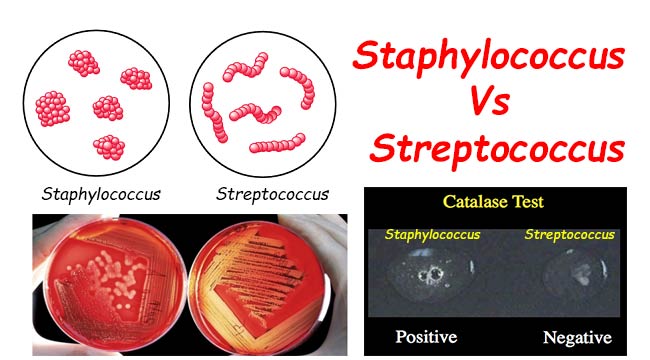 Differences Between Staphylococcus and Streptococcus